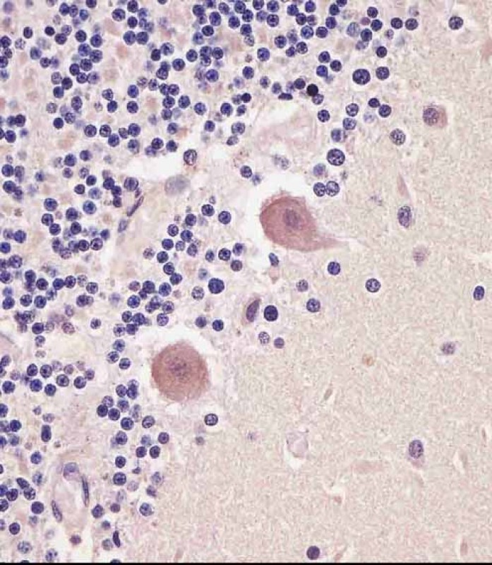 IHC-P - TNMD Antibody AP22288a