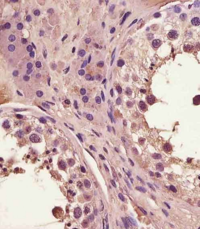 IHC-P - FAM3A Antibody (C-Term) AP22345b