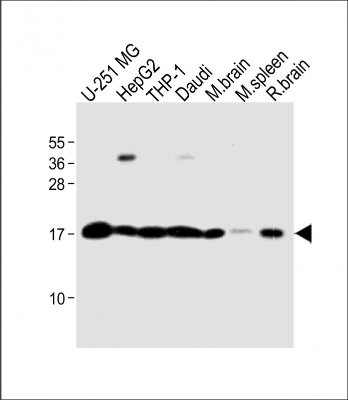 WB - RS18 Antibody (Center) AP6887c