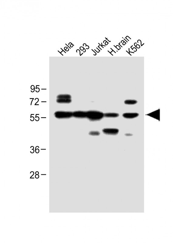 WB - IFNAR1 Antibody (Center) AP8550c