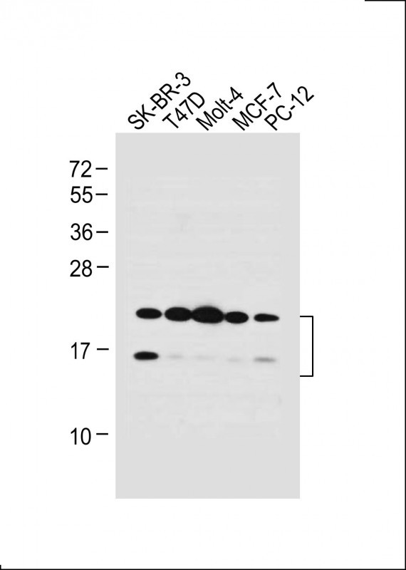 WB - UBE2W Antibody (C-term) AP13607b