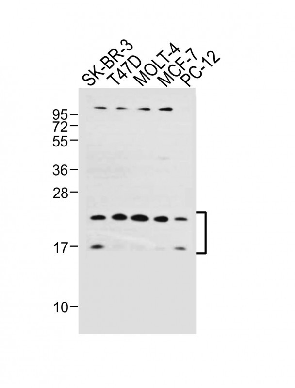 WB - UBE2W Antibody (C-term) AP13607b