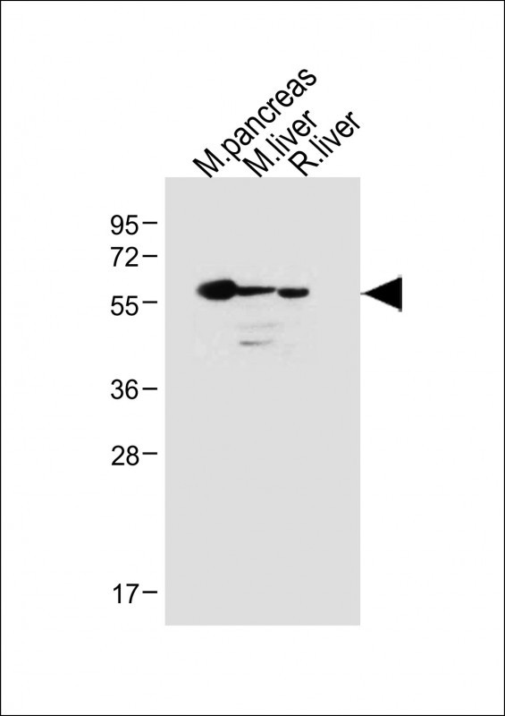 All lanes : Anti-USP30 Antibody (N-term) at 1:500 dilutionLane 1: Mouse pancreas lysateLane 2: Mouse liver lysateLane 3: Rat liver lysateLysates/proteins at 20 �g per lane. SecondaryGoat Anti-Rabbit IgG,  (H+L), Peroxidase conjugated at 1/10000 dilution. Predicted band size : 59 kDaBlocking/Dilution buffer: 5% NFDM/TBST.