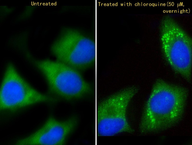 Immunofluorescent analysis of 4% paraformaldehyde-fixed, 0.1% Triton X-100 permeabilized Hela (human cervical epithelial adenocarcinoma cell line)(Hela-C:Serum-starve overnight;Hela-chloroquine?50 ?M, overnight; right)  cells labeling  GABARAP with AP1821a at 1/25 dilution, followed by Dylight� 488-conjugated goat anti-rabbit IgG (1583138) secondary antibody at 1/200 dilution (green). Immunofluorescence image showing cytoplasm and autophagic vacuoles staining on HeLa cell line. Cytoplasmic actin is detected with Dylight� 554 Phalloidin (PD18466410) at 1/100 dilution (red).The nuclear counter stain is DAPI (blue).