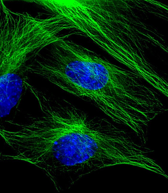 Immunofluorescent analysis of 4% paraformaldehyde-fixed, 0.1% Triton X-100 permeabilized C2C12 (mouse myoblast cell line) cells labeling beta Tubulin with AP22104a at 1/25 dilution, followed by Dylight� 488-conjugated goat anti-rabbit IgG (NK179883) secondary antibody at 1/200 dilution (green). Immunofluorescence image showing cytoplasm staining on C2C12 cell line. The nuclear counter stain is DAPI (blue).