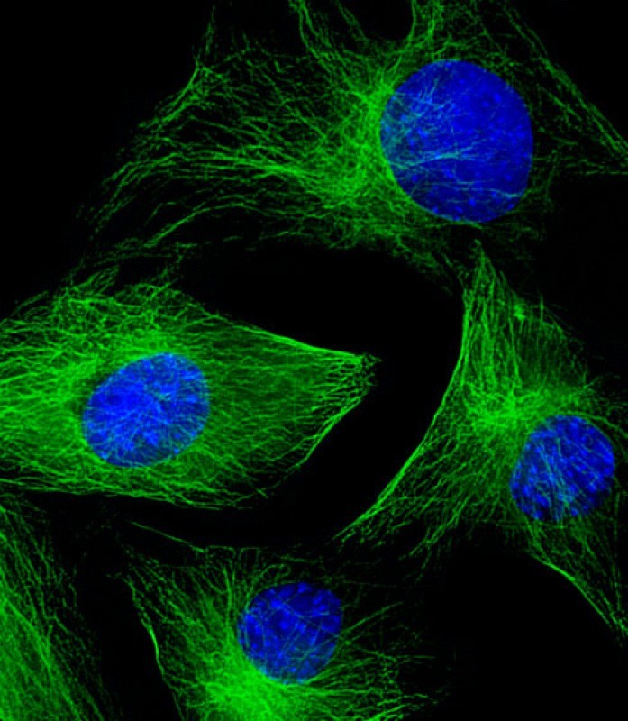 Immunofluorescent analysis of 4% paraformaldehyde-fixed, 0.1% Triton X-100 permeabilized C2C12 (mouse myoblast cell line) cells labeling beta II Tubulin with AP22106a at 1/25 dilution, followed by Dylight� 488-conjugated goat anti-rabbit IgG (NK179883) secondary antibody at 1/200 dilution (green). Immunofluorescence image showing cytoplasm staining on C2C12 cell line. The nuclear counter stain is DAPI (blue).