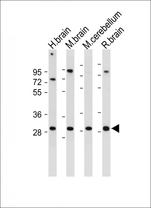 All lanes : Anti-CABP1 Antibody (C-term) at 1:2000 dilutionLane 1: Human brain lysateLane 2: Mouse brain lysateLane 3: Mouse cerebellum lysateLane 4: Rat brain lysateLysates/proteins at 20 �g per lane. SecondaryGoat Anti-Rabbit IgG,  (H+L), Peroxidase conjugated at 1/10000 dilution. Predicted band size : 40 kDaBlocking/Dilution buffer: 5% NFDM/TBST.