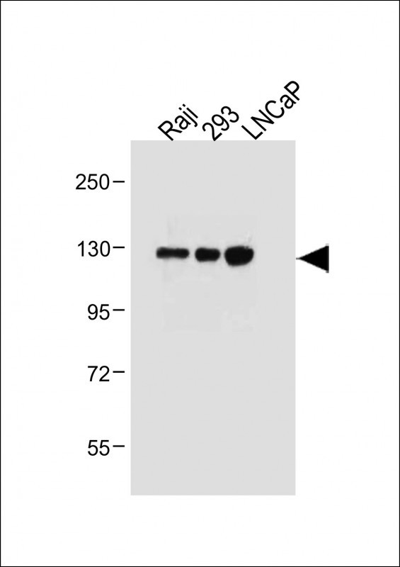 All lanes : Anti-ITGA8 Antibody (C-term) at 1:2000 dilutionLane 1: Raji whole cell lysateLane 2: 293 whole cell lysateLane 3: LNCaP whole cell lysateLysates/proteins at 20 �g per lane. SecondaryGoat Anti-Rabbit IgG,  (H+L), Peroxidase conjugated at 1/10000 dilution. Predicted band size : 117 kDaBlocking/Dilution buffer: 5% NFDM/TBST.