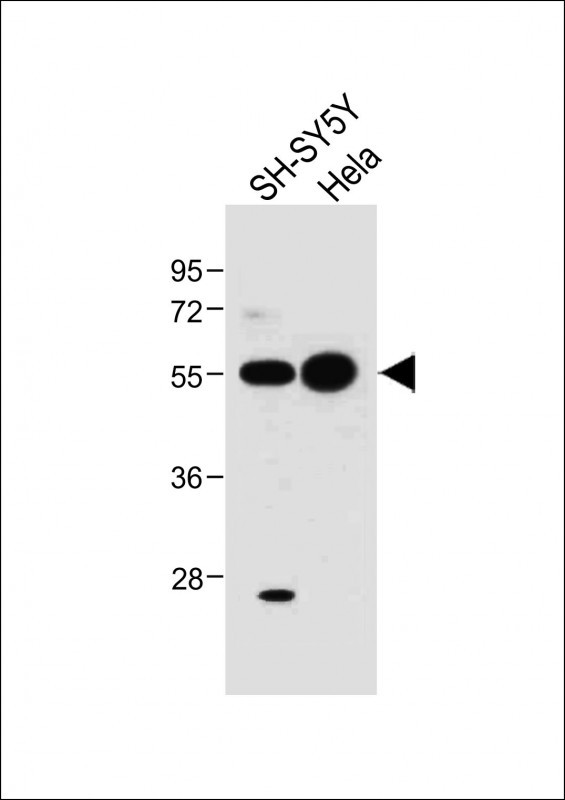 WB - ATG5 Antibody (N-term) AP1812a