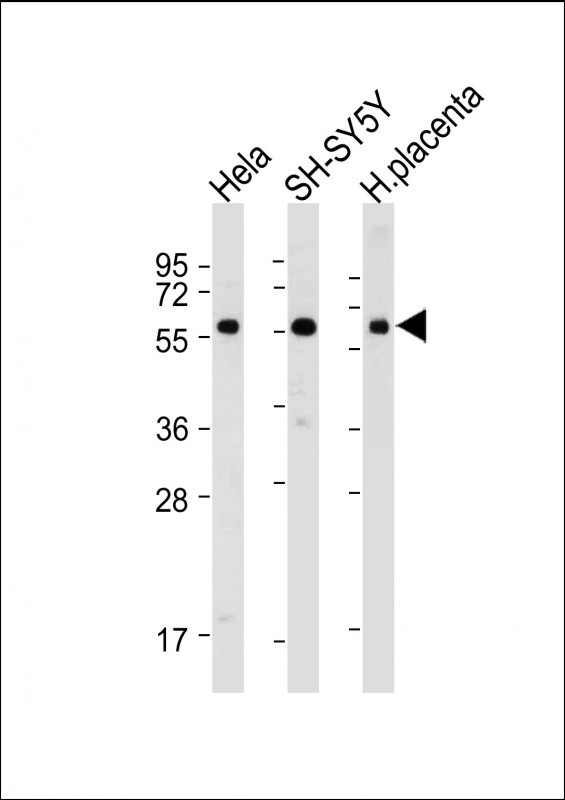 WB - BRD9 Antibody (N-term) AP18588A