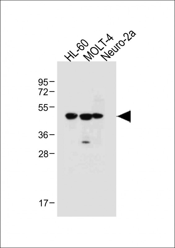 All lanes : Anti-BLMH Antibody (Center) at 1:1000 dilutionLane 1: HL-60 whole cell lysateLane 2: MOLT-4 whole cell lysateLane 3: Neuro-2a whole cell lysateLysates/proteins at 20 �g per lane. SecondaryGoat Anti-Rabbit IgG,  (H+L), Peroxidase conjugated at 1/10000 dilution. Predicted band size : 53 kDaBlocking/Dilution buffer: 5% NFDM/TBST.