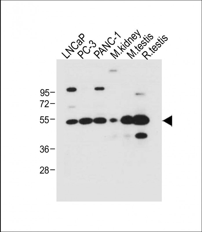 WB - DMRT3 Antibody (C-term) AP10526B