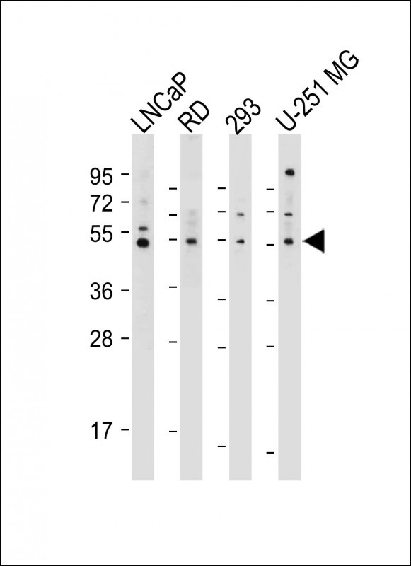 WB - OTUD3 Antibody (Center) AP11031C