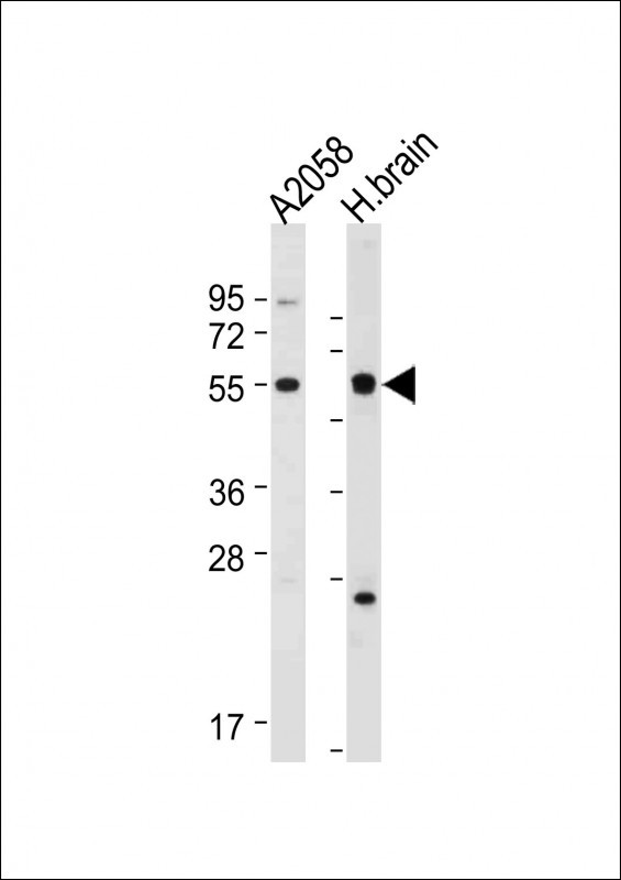 WB - TMX3 Antibody(C-term) AP19606b