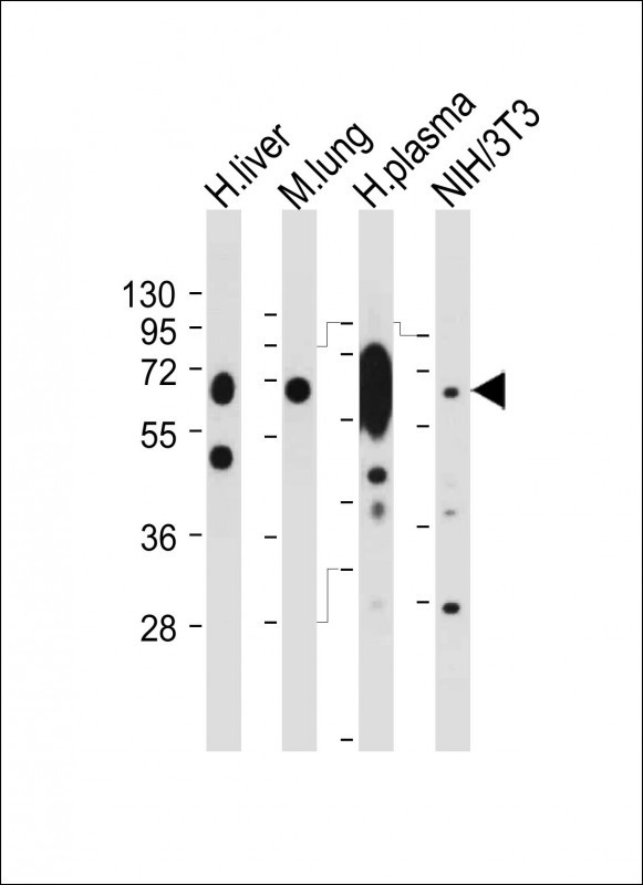 All lanes : Anti-LGALS3BP Antibody (Center) at 1:2000 dilutionLane 1: Human liver tissue lysateLane 2: Mouse lung tissue lysateLane 3: Human plasma tissue lysateLane 4: NIH/3T3 whole cell lysateLysates/proteins at 20 �g per lane. SecondaryGoat Anti-Rabbit IgG,  (H+L), Peroxidase conjugated at 1/10000 dilution. Predicted band size : 65 kDaBlocking/Dilution buffer: 5% NFDM/TBST.