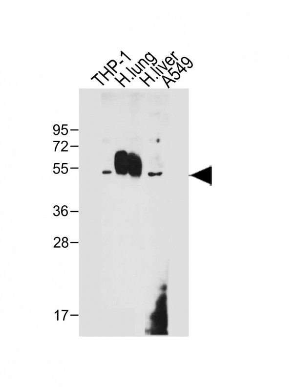 WB - CD14 Antibody (N-term) AP6294A