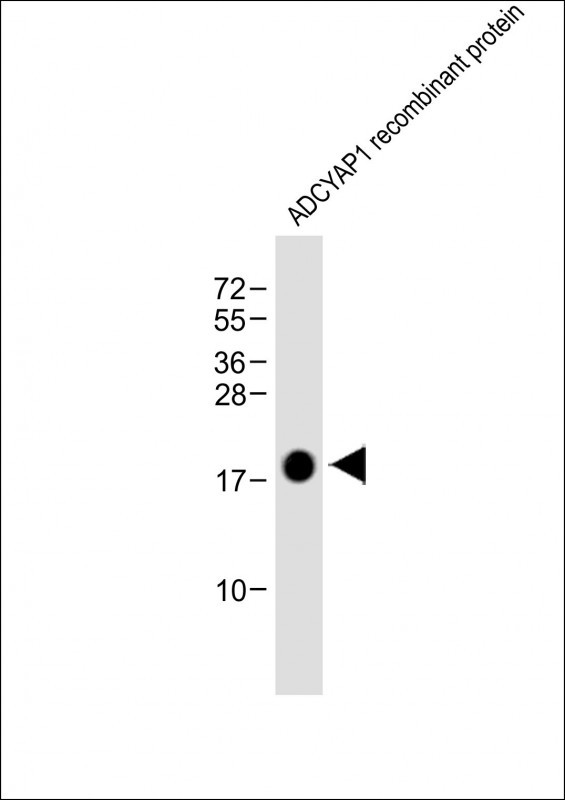 Anti-ADCYAP1 Antibody at 1:8000 dilution + ADCYAP1 recombinant proteinLysates/proteins at 20ng per lane.   SecondaryGoat Anti-mouse IgG,    (H+L),   Peroxidase conjugated at 1/10000 dilution.   Predicted band size : 18 kDaBlocking/Dilution buffer: 5% NFDM/TBST.