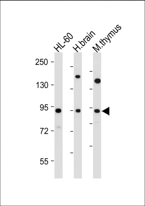 All lanes : Anti-ENASE Antibody  (Center) at 1:2000 dilutionLane 1: HL-60 whole cell lysateLane 2: human brain tissue lysateLane 3: mouse thymus tissue lysateLysates/proteins at 20 �g per lane. SecondaryGoat Anti-Rabbit IgG,  (H+L), Peroxidase conjugated at 1/10000 dilution. Predicted band size : 84 kDaBlocking/Dilution buffer: 5% NFDM/TBST.