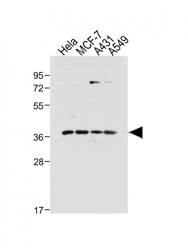 All lanes : Anti-hCdk7-T170 at 1:1000 dilutionLane 1: Hela whole cell lysateLane 2: MCF-7 whole cell lysateLane 3: A431 whole cell lysateLane 4: A549 whole cell lysateLysates/proteins at 20 �g per lane. SecondaryGoat Anti-Rabbit IgG,  (H+L), Peroxidase conjugated at 1/10000 dilution. Predicted band size : 39 kDaBlocking/Dilution buffer: 5% NFDM/TBST.