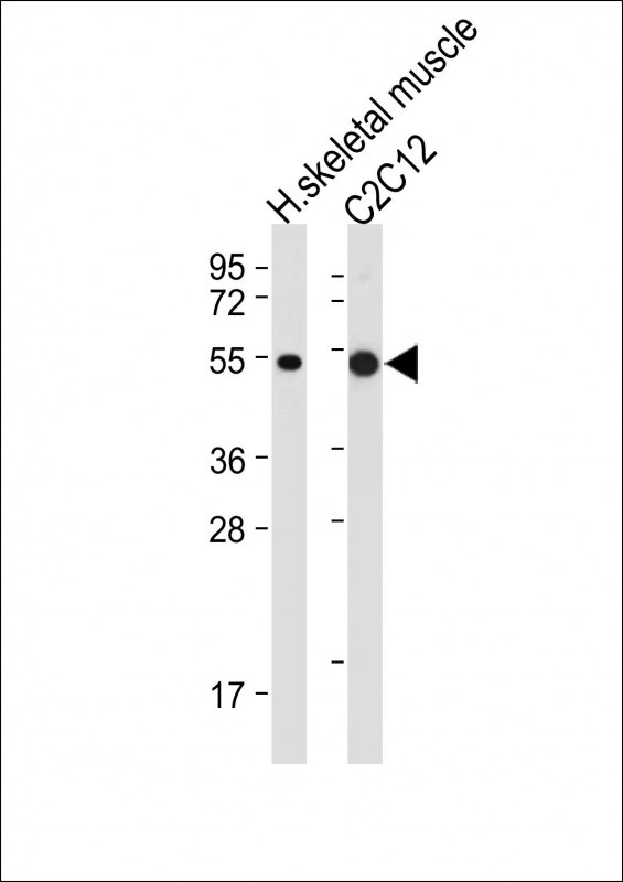 All lanes : Anti-SLC16A3 Antibody (C-term) at 1:2000 dilutionLane 1: Human skeletal muscle tissue lysateLane 2: C2C12 whole cell lysateLysates/proteins at 20 �g per lane. SecondaryGoat Anti-Rabbit IgG,  (H+L), Peroxidase conjugated at 1/10000 dilution. Predicted band size : 49 kDaBlocking/Dilution buffer: 5% NFDM/TBST.