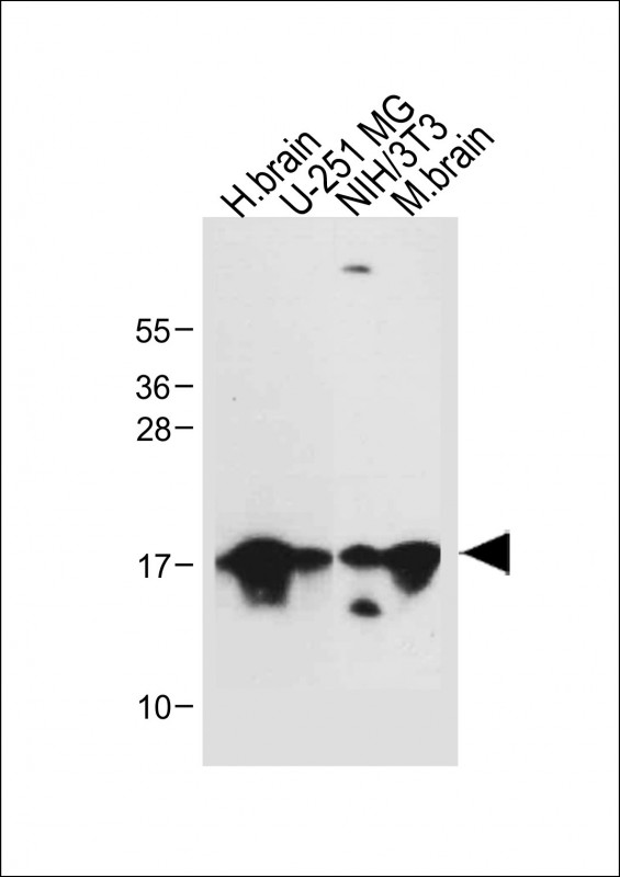 All lanes : Anti-MAP1LC3A antibody(N-term) at 1:500 dilutionLane 1: Human brain tissue lysateLane 2: U-251 MG whole cell lysateLane 3: NIH/3T3 whole cell lysateLane 4: Mouse brain tissue lysateLysates/proteins at 20 �g per lane.  SecondaryGoat Anti-Rabbit IgG,   (H+L),  Peroxidase conjugated at 1/10000 dilution.  Predicted band size : 14 kDaBlocking/Dilution buffer: 5% NFDM/TBST.