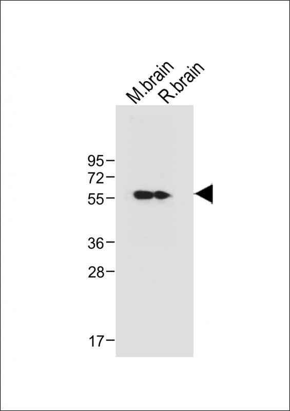 All lanes : Anti-CAMK2D (CAMK2 delta) Antibody (C-term) at 1:1000 dilutionLane 1: Mouse brain tissue lysateLane 2: Rat brain tissue lysateLysates/proteins at 20 �g per lane. SecondaryGoat Anti-Rabbit IgG,  (H+L), Peroxidase conjugated at 1/10000 dilution. Predicted band size : 56 kDaBlocking/Dilution buffer: 5% NFDM/TBST.