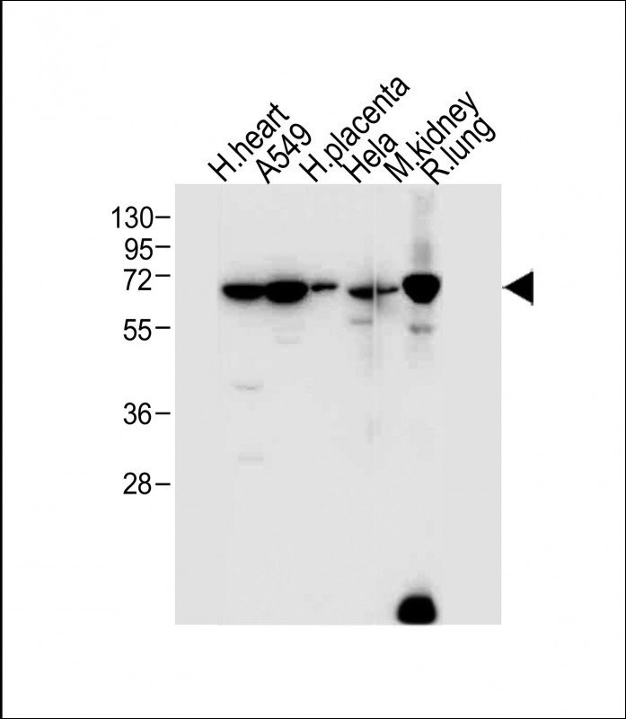 All lanes : Anti-EHD2 Antibody (C-term) at 1:1000 dilutionLane 1: Human heart tissue lysateLane 2: A549 whole cell lysateLane 3: Human placenta tissuee lysateLane 4: Hela whole cell lysateLane 5: Mouse kidney tissue lysateLane 6: Rat lung tissue lysateLysates/proteins at 20 �g per lane. SecondaryGoat Anti-Rabbit IgG,  (H+L), Peroxidase conjugated at 1/10000 dilution. Predicted band size : 61 kDaBlocking/Dilution buffer: 5% NFDM/TBST.