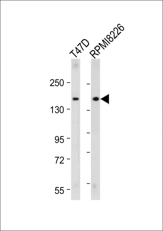 All lanes : Anti-ABCC12 Antibody (Center) at 1:2000 dilutionLane 1: T47D whole cell lysateLane 2: RPMI8226 whole cell lysateLysates/proteins at 20 �g per lane. SecondaryGoat Anti-Rabbit IgG,  (H+L), Peroxidase conjugated at 1/10000 dilution. Predicted band size : 152 kDaBlocking/Dilution buffer: 5% NFDM/TBST.