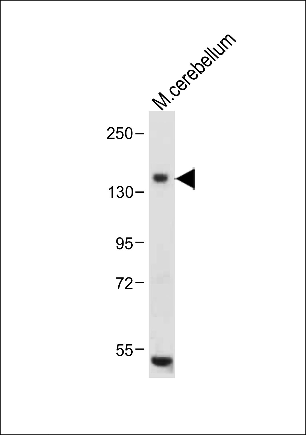 Anti-c-KIT Antibody (N-term) at 1:1000 dilution+ Mouse cerebellum tissue lysateLysates/proteins at 20 �g per lane.  SecondaryGoat Anti-Rabbit IgG,  (H+L), Peroxidase conjugated at 1/10000 dilution.  Predicted band size : 110 kDa Blocking/Dilution buffer: 5% NFDM/TBST.