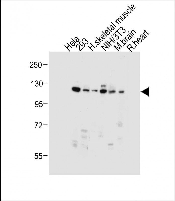 All lanes : Anti-Dnmt3a Antibody at 1:1000 dilutionLane 1: Hela whole cell lysateLane 2: 293 whole cell lysateLane 3: Human skeletal muscle tissue lysateLane 4: NIH/3T3 whole cell lysateLane 5: Mouse brain tissue lysateLane 6: Rat heart tissue lysateLysates/proteins at 20 �g per lane. SecondaryGoat Anti-Rabbit IgG,  (H+L), Peroxidase conjugated at 1/10000 dilution. Predicted band size : 102 kDaBlocking/Dilution buffer: 5% NFDM/TBST.