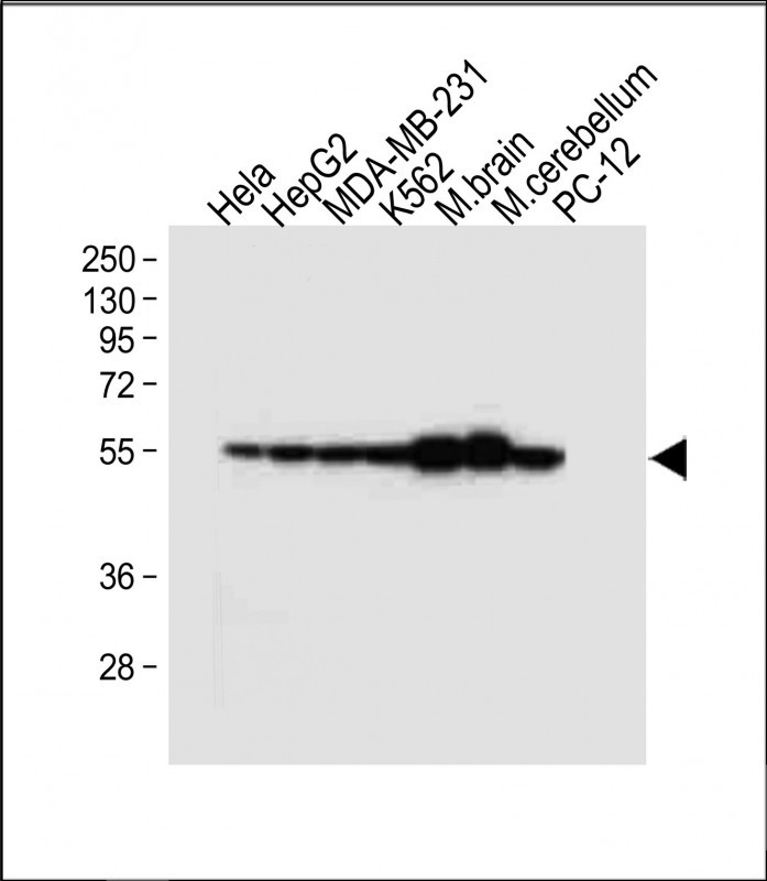 All lanes : Anti-TUBB2B Antibody (N-term) at 1:4000 dilutionLane 1: Hela whole cell lysateLane 2: HepG2 whole cell lysateLane 3: MDA-MB-231 whole cell lysateLane 4: K562 whole cell lysateLane 5: Mouse brain tissue lysateLane 6: Mouse cerebellum tissue lysateLane 7: PC-12 whole cell lysateLysates/proteins at 20 �g per lane. SecondaryGoat Anti-Rabbit IgG,  (H+L), Peroxidase conjugated at 1/10000 dilution. Predicted band size : 50 kDaBlocking/Dilution buffer: 5% NFDM/TBST.