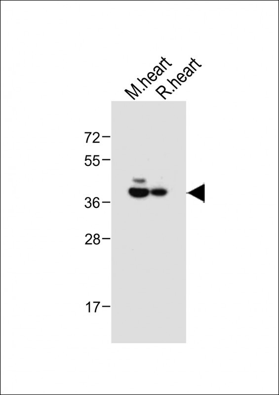 WB - LPAR6 Antibody (Center) AP12707c