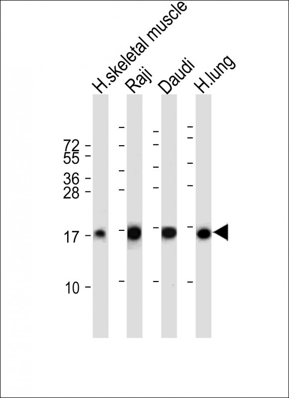 All lanes : Anti-TSC22D3 Antibody (Center) at 1:2000 dilutionLane 1: Human skeletal muscle tissue lysateLane 2: Raji whole cell lysateLane 3: Daudi whole cell lysateLane 4: Human lung tissue lysateLysates/proteins at 20 �g per lane. SecondaryGoat Anti-Rabbit IgG,  (H+L), Peroxidase conjugated at 1/10000 dilution. Predicted band size : 15 kDaBlocking/Dilution buffer: 5% NFDM/TBST.
