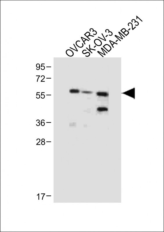 All lanes : Anti-AMHR2 Antibody (N-term) at 1:1000 dilutionLane 1: OVCAR3 whole cell lysateLane 2: SK-OV-3 whole cell lysateLane 3: MDA-MB-231 whole cell lysateLysates/proteins at 20 �g per lane. SecondaryGoat Anti-Rabbit IgG,  (H+L), Peroxidase conjugated at 1/10000 dilution. Predicted band size : 63 kDaBlocking/Dilution buffer: 5% NFDM/TBST.