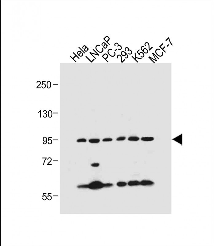 All lanes : Anti-PKN beta Antibody (C-term) at 1:500 dilutionLane 1: Hela whole cell lysateLane 2: LNCaP whole cell lysateLane 3: PC-3 whole cell lysateLane 4: 293 whole cell lysateLane 5: K562 whole cell lysateLane 6: MCF-7 whole cell lysateLysates/proteins at 20 �g per lane. SecondaryGoat Anti-Rabbit IgG,  (H+L), Peroxidase conjugated at 1/10000 dilution. Predicted band size : 99 kDaBlocking/Dilution buffer: 5% NFDM/TBST.
