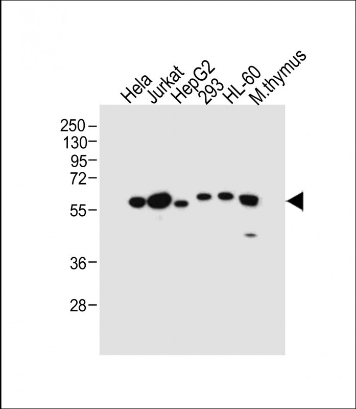 All lanes : Anti-PDCD4 Antibody (Center) at 1:2000 dilutionLane 1: Hela whole cell lysateLane 2: Jurkat whole cell lysateLane 3: HepG2 whole cell lysateLane 4: 293 whole cell lysateLane 5: HL-60 whole cell lysateLane 6: Mouse thymus tissue lysateLysates/proteins at 20 �g per lane. SecondaryGoat Anti-Rabbit IgG,  (H+L), Peroxidase conjugated at 1/10000 dilution. Predicted band size : 52 kDaBlocking/Dilution buffer: 5% NFDM/TBST.