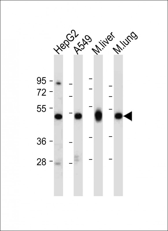 All lanes : Anti-ALDH2 Antibody (Center) at 1:2000 dilutionLane 1: HepG2 whole cell lysateLane 2: A549 whole cell lysateLane 3: Mouse liver tissue lysateLane 4: Mouse lung tissue lysateLysates/proteins at 20 �g per lane.  SecondaryGoat Anti-Rabbit IgG,   (H+L),  Peroxidase conjugated at 1/10000 dilution.  Predicted band size : 56 kDaBlocking/Dilution buffer: 5% NFDM/TBST.