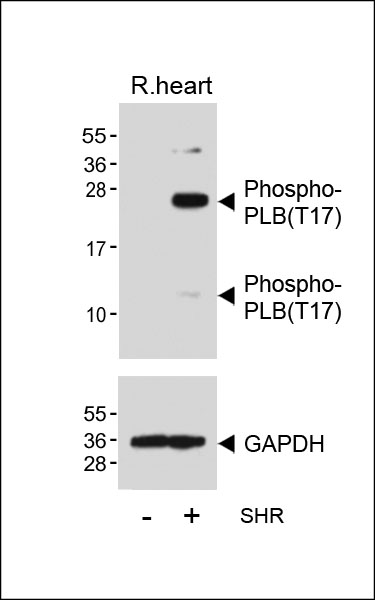 Western blot analysis of lysates from Rat heart tissue and spontaneous hypertensive (SHR) rat heart tissue lysate, using Phospho-PLB(T17) Antibody(Cat.  #AP3694a)(upper) or GAPDH (lower).
