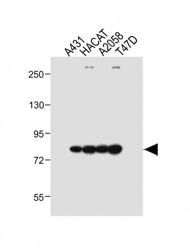 All lanes : Anti-ALOXE3 Antibody (Center) at 1:1000 dilutionLane 1: A431 whole cell lysateLane 2: HACAT whole cell lysateLane 3: A2058 whole cell lysateLane 4: T47D whole cell lysateLysates/proteins at 20 �g per lane. SecondaryGoat Anti-Rabbit IgG,  (H+L), Peroxidase conjugated at 1/10000 dilution. Predicted band size : 81 kDaBlocking/Dilution buffer: 5% NFDM/TBST.