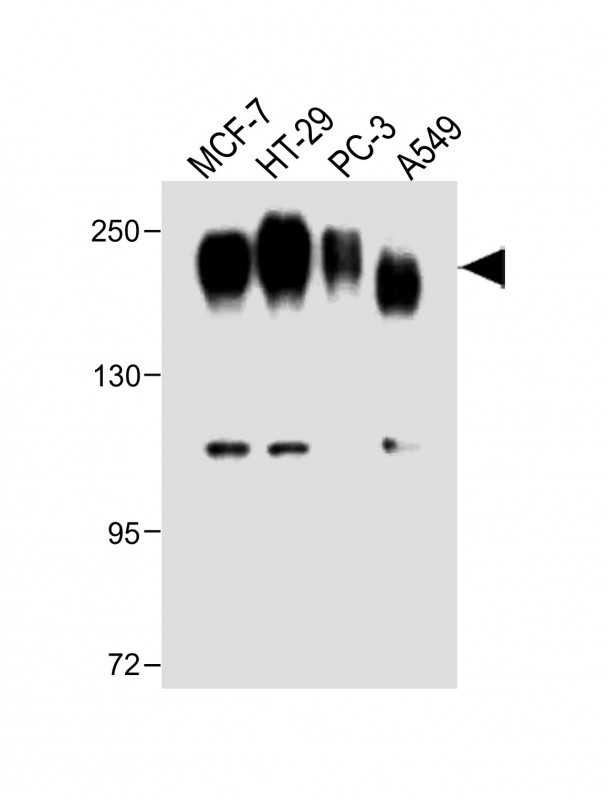 All lanes : Anti-CEA Antibody (Center) at 1:1000 dilutionLane 1: MCF-7 whole cell lysateLane 2: HT-29 whole cell lysateLane 3: PC-3 whole cell lysateLane 4: A549 whole cell lysateLysates/proteins at 20 �g per lane. SecondaryGoat Anti-Rabbit IgG,  (H+L), Peroxidase conjugated at 1/10000 dilution. Predicted band size : 77 kDaBlocking/Dilution buffer: 5% NFDM/TBST.