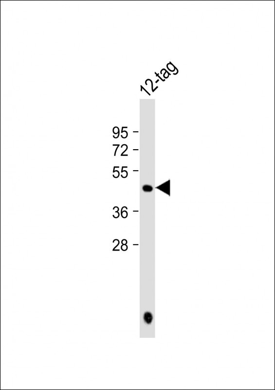 Anti-HIS Tag at 1:8000 dilution + 12-tag lysate Lysates/proteins at 20ng per lane. Secondary Goat Anti-mouse IgG, (H+L), Peroxidase conjugated at 1/10000 dilution. Predicted band size : 48 kDa Blocking/Dilution buffer: 5% NFDM/TBST.