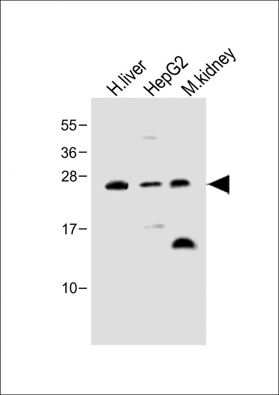 All lanes : Anti-Erythropoietin Antibody at 1:500 dilutionLane 1: Human liver lysateLane 2: HepG2 whole cell lysateLane 3: Mouse kidney lysateLysates/proteins at 20 �g per lane. SecondaryGoat Anti-Rabbit IgG,  (H+L), Peroxidase conjugated at 1/10000 dilution. Predicted band size : 21 kDaBlocking/Dilution buffer: 5% NFDM/TBST.