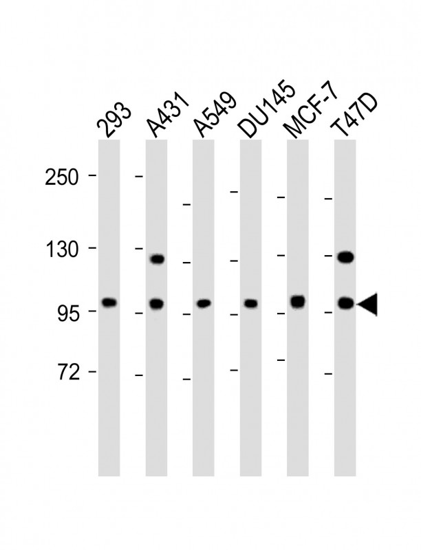 WB - E Cadherin (CDH1) Antibody (N-term) AP1477a