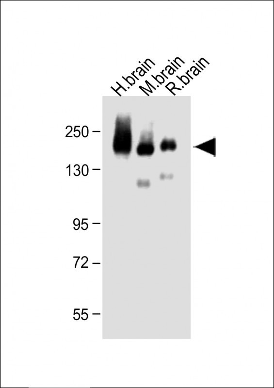 WB - NCAM1 Antibody (C-term) AP20927c