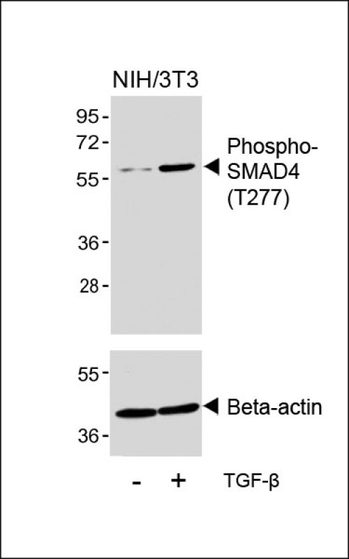 WB - Phospho-SMAD4(T277) Antibody AP3251a
