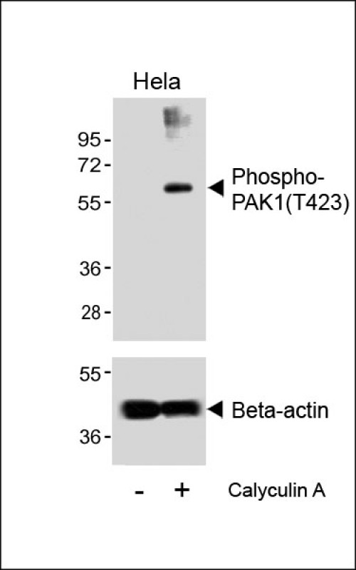 Western blot analysis of lysates from Hela cell line,        untreated or treated with EGF(1�g/ml,        10min),        using Phospho-PAK1(T423) Antibody(upper) or Beta-actin (lower).