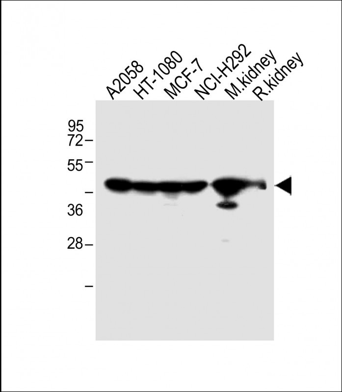 All lanes : Anti-MMP14 Antibody (N-term) at 1:2000 dilutionLane 1: A2058 whole cell lysateLane 2: HT-1080 whole cell lysateLane 3: MCF-7 whole cell lysateLane 4: NCI-H292 whole cell lysateLane 5: Mouse kidney lysateLane 5: Rat kidney lysateLysates/proteins at 20 �g per lane. SecondaryGoat Anti-Rabbit IgG,  (H+L), Peroxidase conjugated at 1/10000 dilution. Predicted band size : 66 kDaBlocking/Dilution buffer: 5% NFDM/TBST.