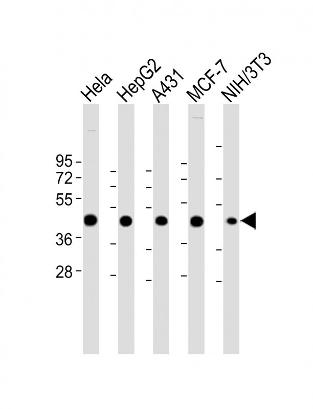 All lanes : Anti-Beta-actin Antibody at 1:4000-1:8000 dilutionLane 1: Hela whole cell lysateLane 2: HepG2 whole cell lysateLane 3: A431 whole cell lysateLane 4: MCF-7 whole cell lysateLane 5: NIH/3T3 whole cell lysateLysates/proteins at 20 �g per lane. SecondaryGoat Anti-mouse IgG,  (H+L), Peroxidase conjugated at 1/10000 dilution. Predicted band size : 42 kDaBlocking/Dilution buffer: 5% NFDM/TBST.