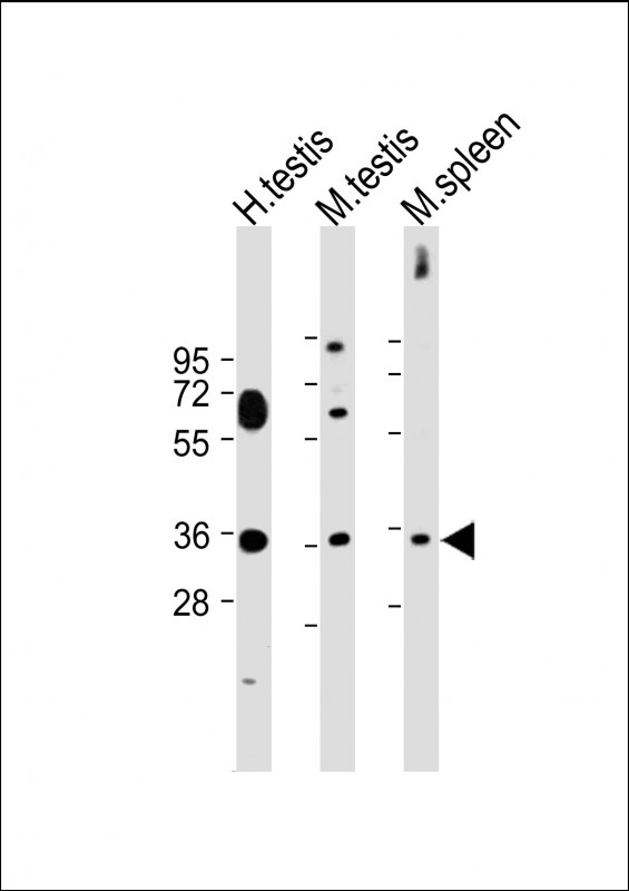 WB - ASB17 Antibody (C-term) AP10825b