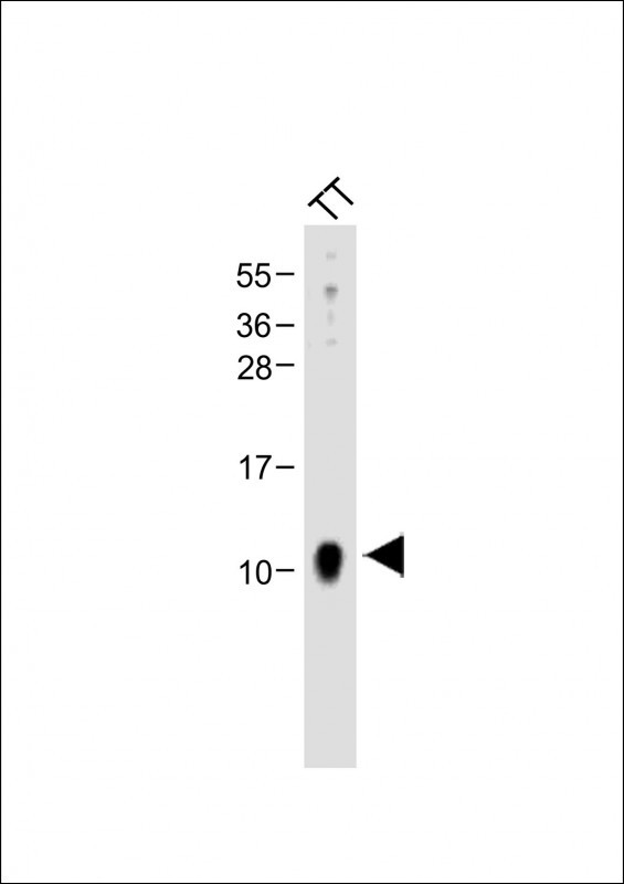 Anti-CALCA Antibody (Center) at 1:2000 dilution + TT whole cell lysateLysates/proteins at 20 �g per lane. SecondaryGoat Anti-Rabbit IgG,  (H+L), Peroxidase conjugated at 1/10000 dilution. Predicted band size : 14 kDaBlocking/Dilution buffer: 5% NFDM/TBST.